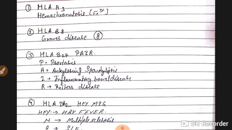 Associated Bank Car Loan: Your Ultimate Guide to Driving Away with Confidence