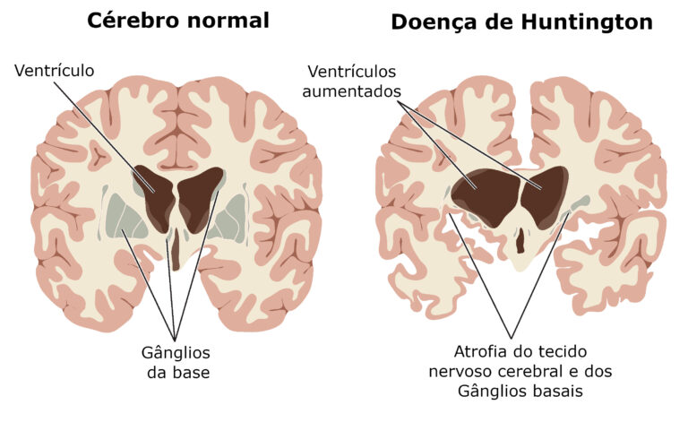 Mastering Your Huntington Bank Car Loan: A Comprehensive Guide to Seamless Payments & Smart Management